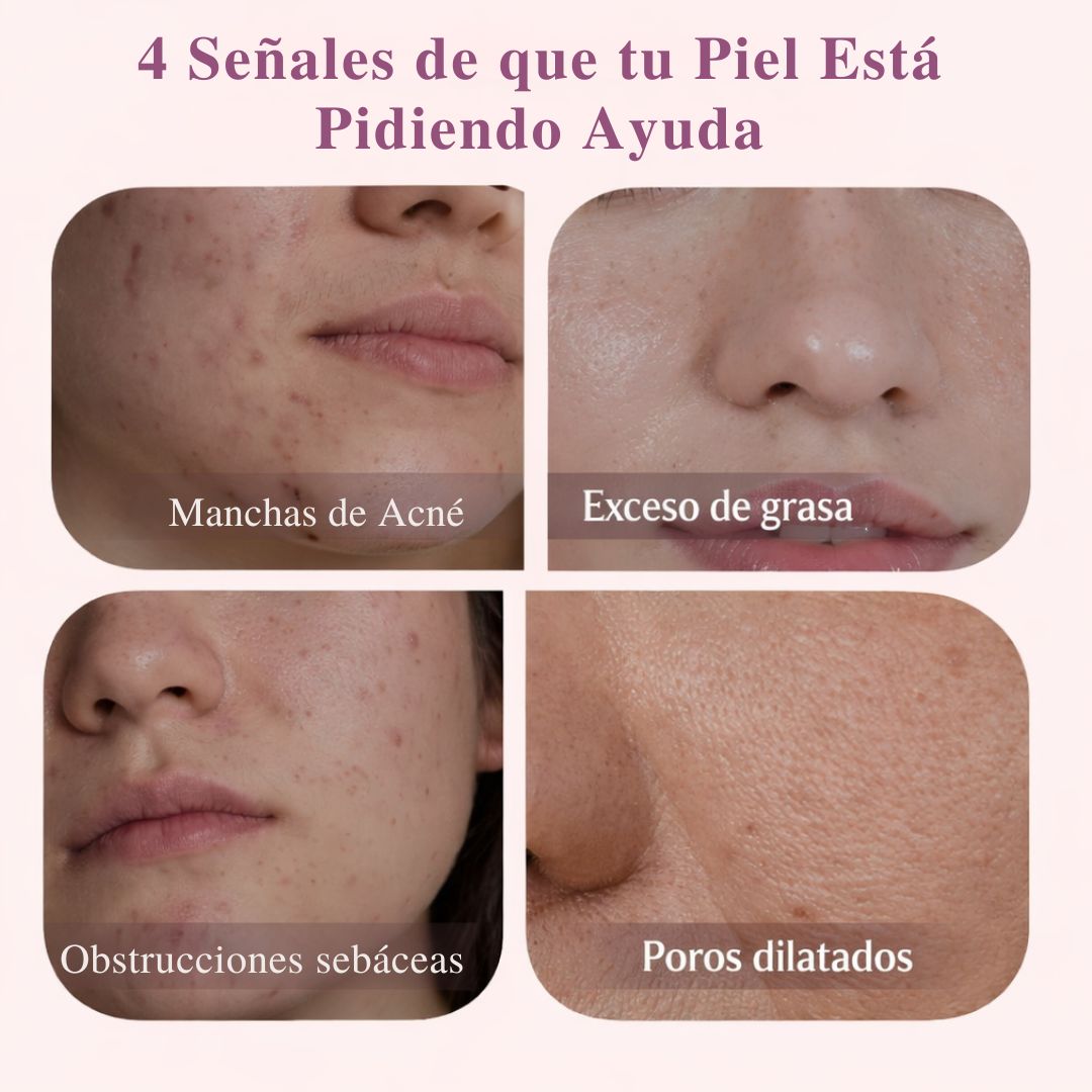 Sérum Renovador Sin Manchas – Velmyra®