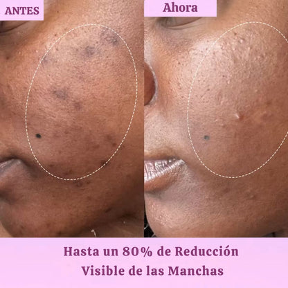 Sérum Renovador Sin Manchas – Velmyra®